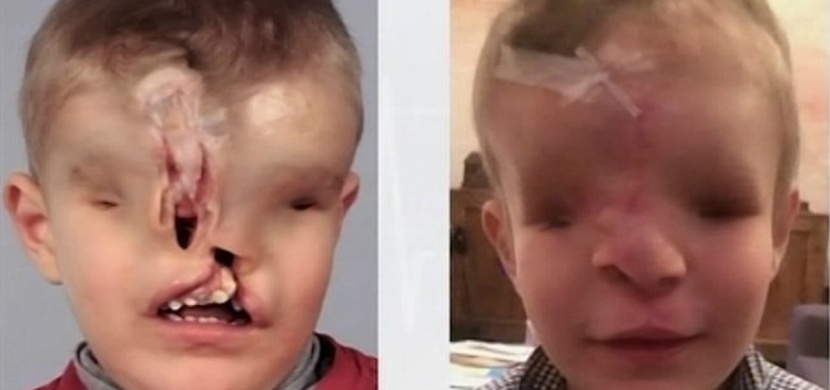 He didn't have a mouth, nose or eyes and everybody was afraid of him. But when you see how he looks today, you won't be able to stop the tears...